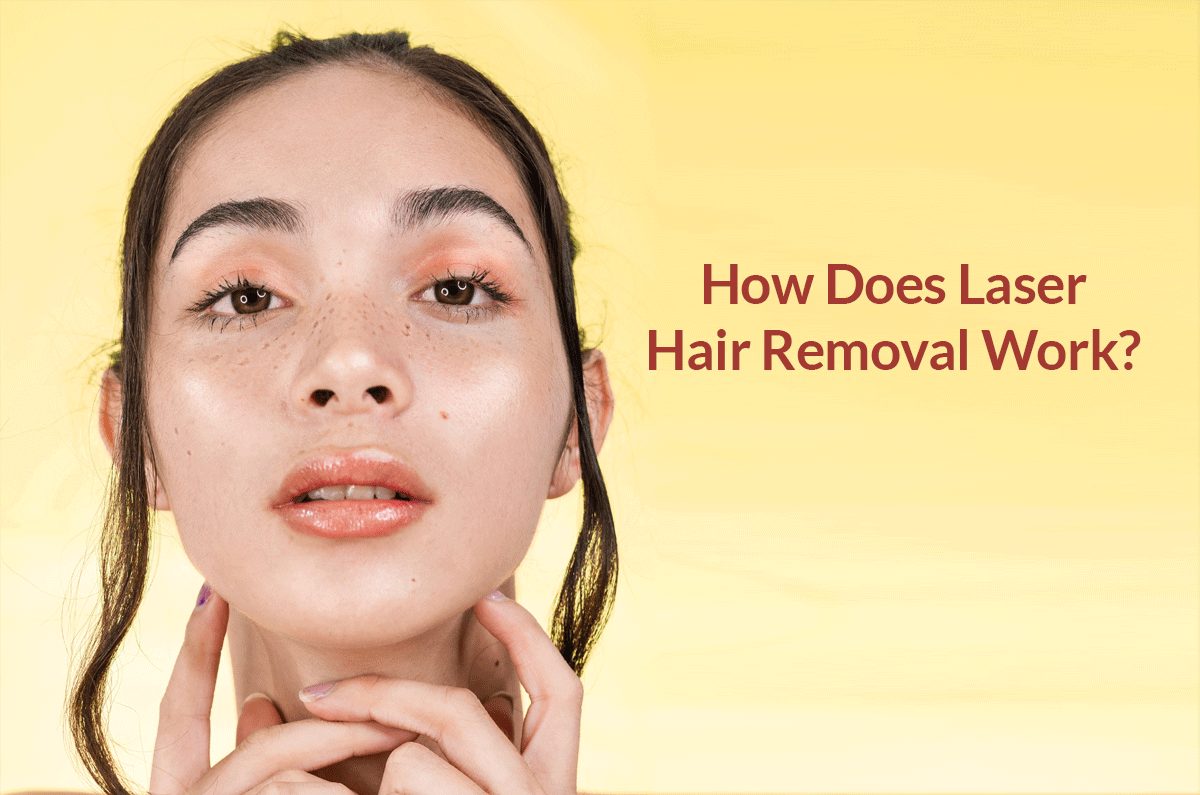 What is Laser Hair Removal