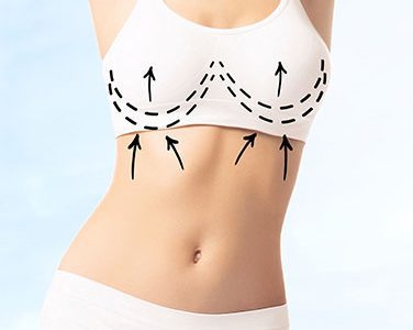 Breast Lift-FeaturedImage