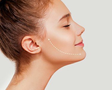 Kybella-FeaturedImage