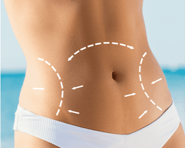 TummyTuck-FeaturedImage